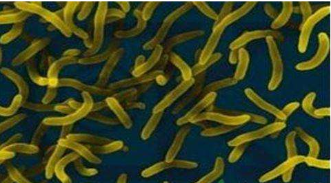 微生物菌劑好？好在哪里您知道嗎？